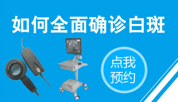 發際線邊上有一點皮膚很白是白癜風嗎