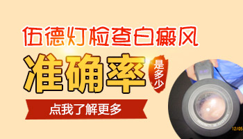伍德氏燈能檢查白斑是不是白癜風準確嗎