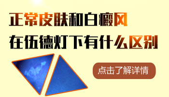 區分白癜風和白斑的方法是什么