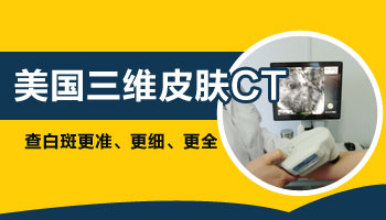 皮膚鏡跟伍德燈檢查白斑有什么差別