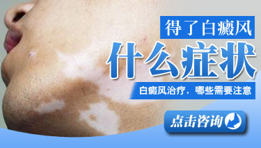 白癜風疾病的癥狀有哪幾種