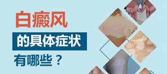 不同時期的白癜風顏色是什么樣的