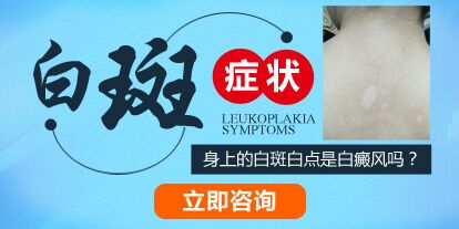 孩子臉上有淡白斑圖片