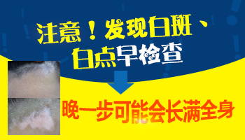 手指上出現許多小白點點是怎么了