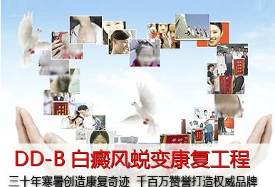 白癜風(fēng)治療偏方有什么