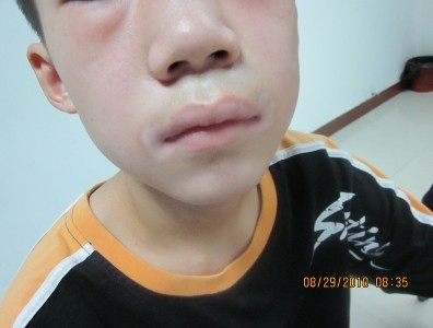 平山中醫治療白癜風的好醫院