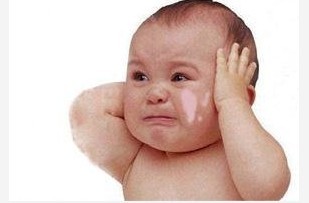 小兒面部長白癜風該用什么方法治療?