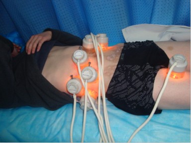 白癜風植皮怎樣才成功