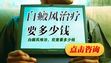 白癜風醫院的308是怎么收費的
