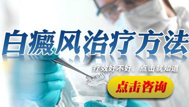 白癜風(fēng)總之好什么原因