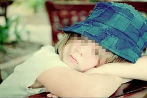 寶寶發(fā)育期間皮膚長(zhǎng)白斑怎么治療