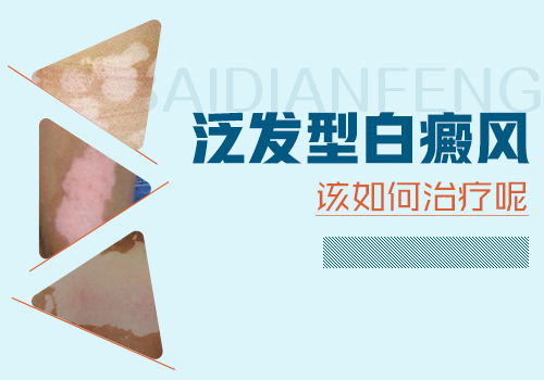  面積大的白癜風(fēng)涂藥吃藥能好嗎