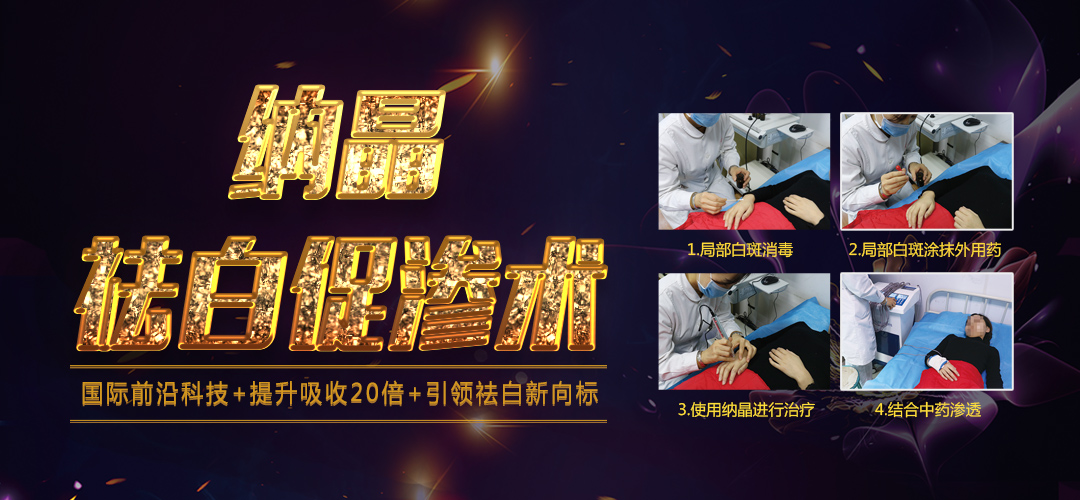 面部隱形白癜風可以做納晶定向嗎