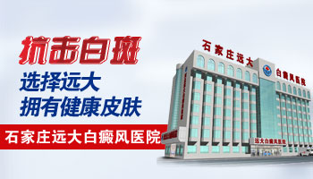 白癜風好像比原來大了點怎么辦