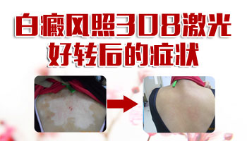 面部小白點照308激光好轉癥狀有哪些