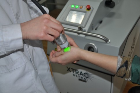 激光治療白癜風處治療后發(fā)癢