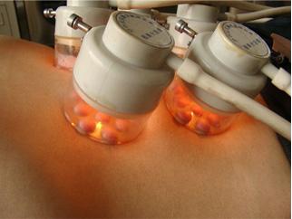 黑色素種植后皮膚發黑怎么回事