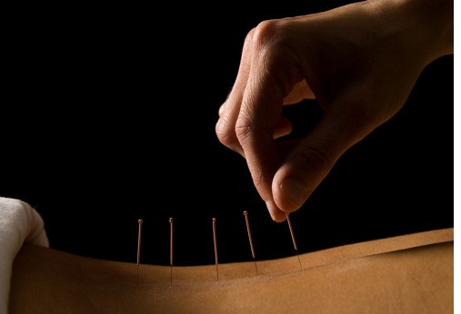 中醫(yī)針灸對白癜風(fēng)治療有幫助嗎