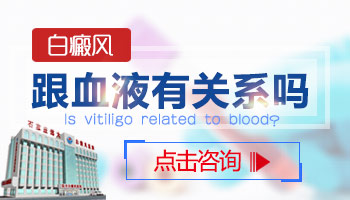 檢查白斑是不是白癜風還用抽血嗎