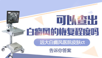 白斑照308激光發(fā)紅是有效果嗎