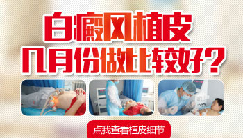 手指白癜風能做移植手術嗎