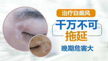 肛門周圍長(zhǎng)白癜風(fēng)不治療會(huì)怎么樣