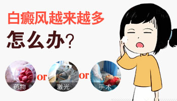 腿部白癜風(fēng)越來(lái)越多怎么治療好