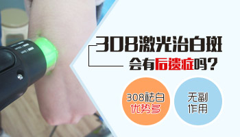 白癜風做完308紅了能涂卡泊嗎