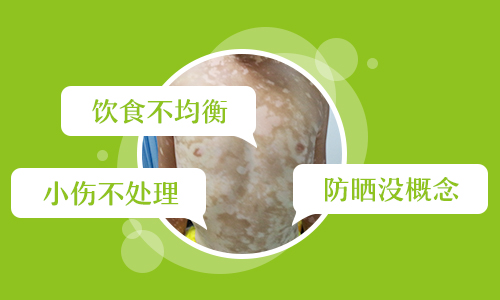 7個月孩子胸部圓形白塊照308激光3次不見效怎么辦