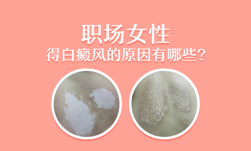 4個月孩子手上有塊白斑照伍德燈顯熒光是不是白癜風