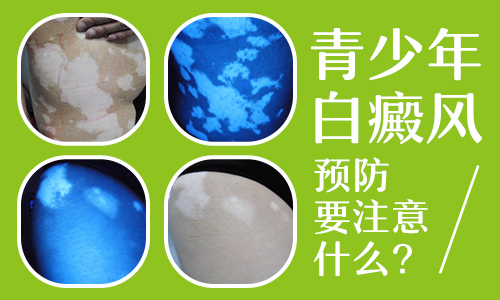 腹部白癜風有拳頭大照308激光一個療程多少錢