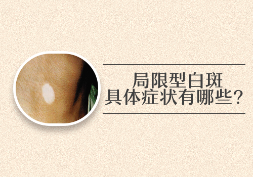 面部有白癜風照308多少錢,長期照射好嗎