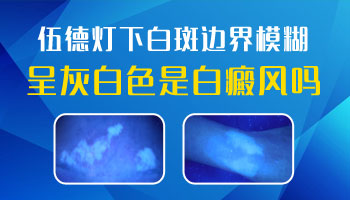 7個月孩子胸部圓形白斑伍德燈檢查為陽性是白癜風(fēng)嗎