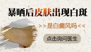 兒童腿上有片白只照308激光能控制住嗎