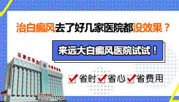 兒童面部長白癜風中西醫結合治療怎么樣