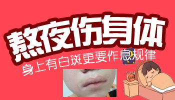 兒童腰部有片白照uvb一次要多少錢