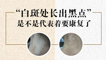 8個月孩子腳上有白點照伍德燈顯熒光白是什么意思