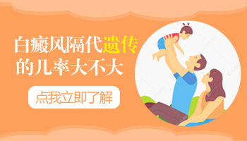兒童腿上長白癜風怎么治療科學