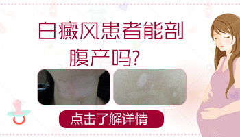 手上有白斑照308激光一個療程多少錢