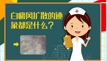 7個月孩子耳朵有一小塊白斑只照激光能好嗎