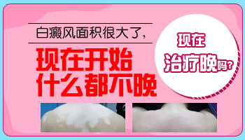 4個月孩子胳膊有白斑能用黑色素移植手術治療嗎