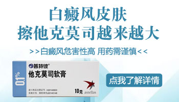 腳上有白癜風照308激光費用高嗎