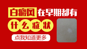 4個月孩子手上有一小塊白塊像白癜風嗎，哪種方法確診