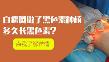 7個(gè)月孩子胸部硬幣大白斑是什么病，伍德燈可以檢查嗎