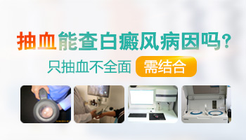 4個月孩子手上有一小塊白斑照伍德燈顯瓷白色是白癜風(fēng)嗎