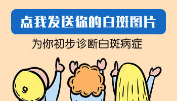 4個月孩子手上有白塊伍德燈檢查為陽性是白癜風嗎