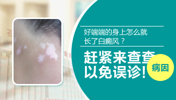 4個月孩子胳膊硬幣大白斑用什么方法治療好的快