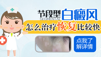 8個(gè)月孩子腳上硬幣大白斑是不是白癜風(fēng)怎么判斷