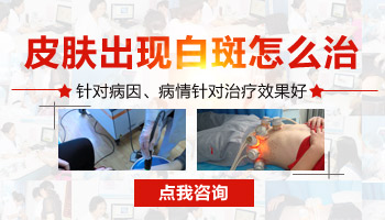 嘴角有發(fā)展期白癜風(fēng)照308激光好不好，一次多少錢