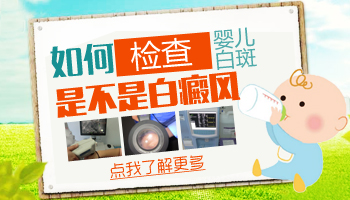7個月孩子胸部硬幣大白斑怎么形成的，白斑怎么治療